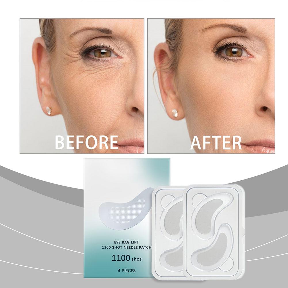 Hyaluronic Acid Microneedle Ey - đánh giá và giá Microneedle Patch Eye