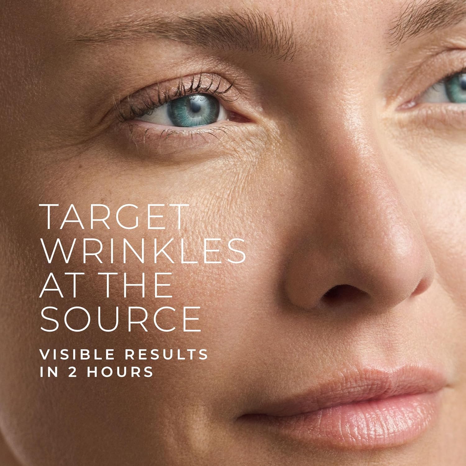 Hyaluronic Acid Retinol Micron - đánh giá và giá Microneedle Patch Eye